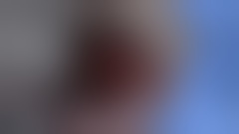 Evisceration for endophthalmitis