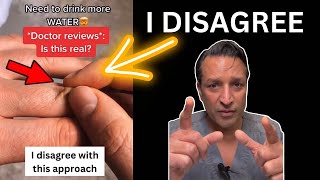 Celebrity DEHYDRATION TEST: Why this did NOT work for me. Net Worth