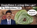 Science of betel leaf  betel nut tamil  benefits of betel leaves  dr ramakrishnan md