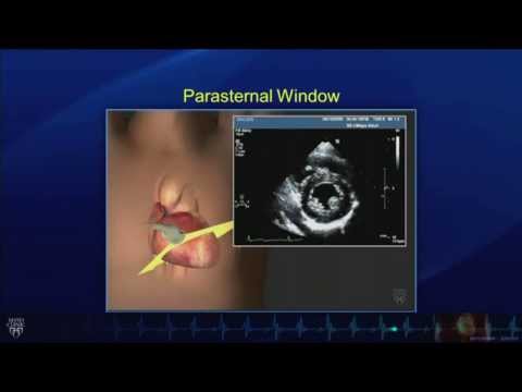 Echo Tutorial: Comprehensive Transthoracic Echocardiogram - Mayo Clinic