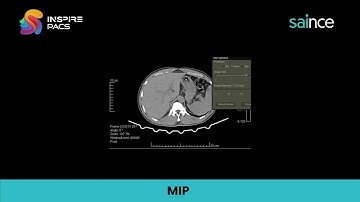 Saince Inspire PACS MIP tool demo