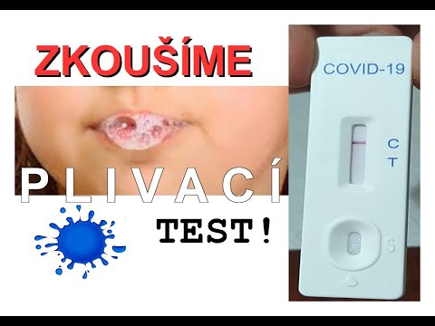 Video: Lipázový Test: Účel, Postup A Výsledky