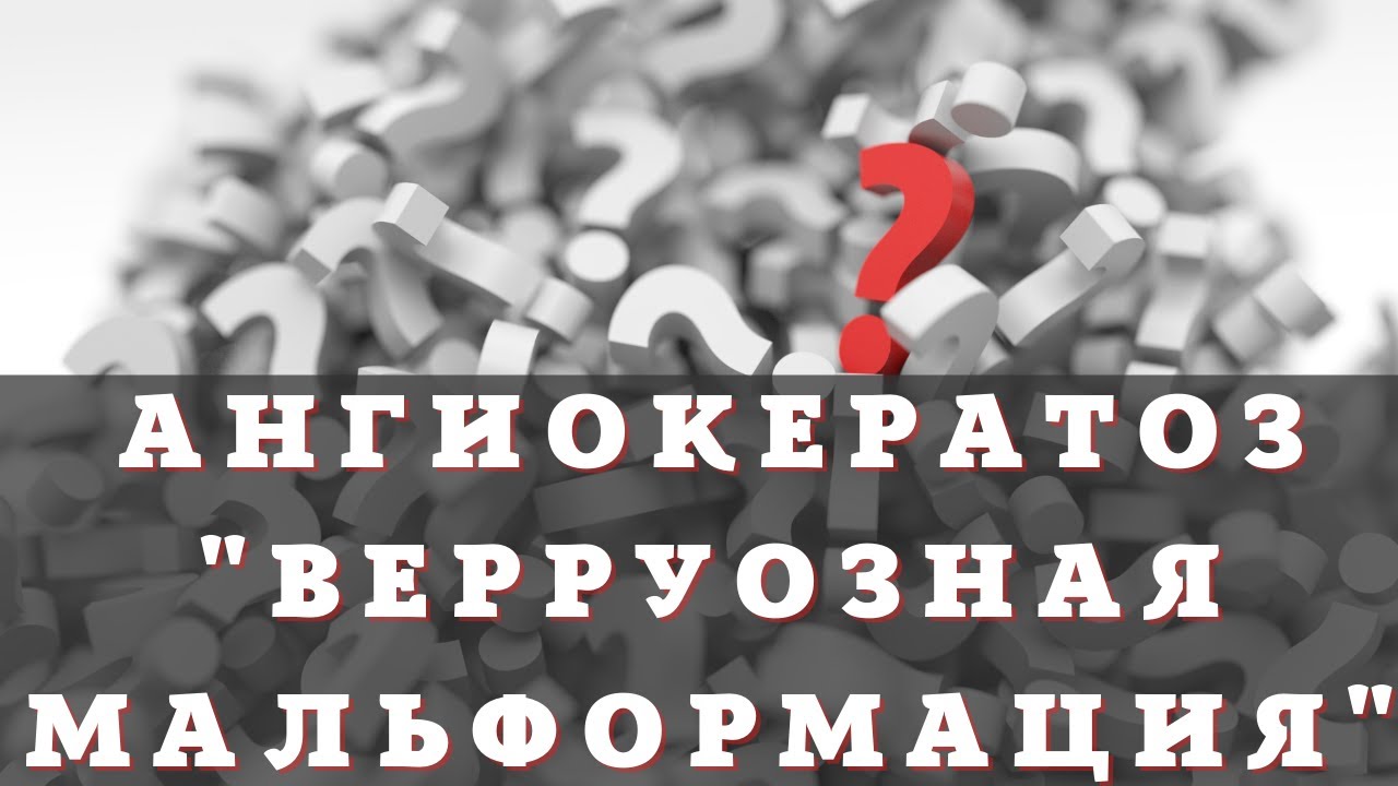 Ангиокератоз (верркуозная мальформация)