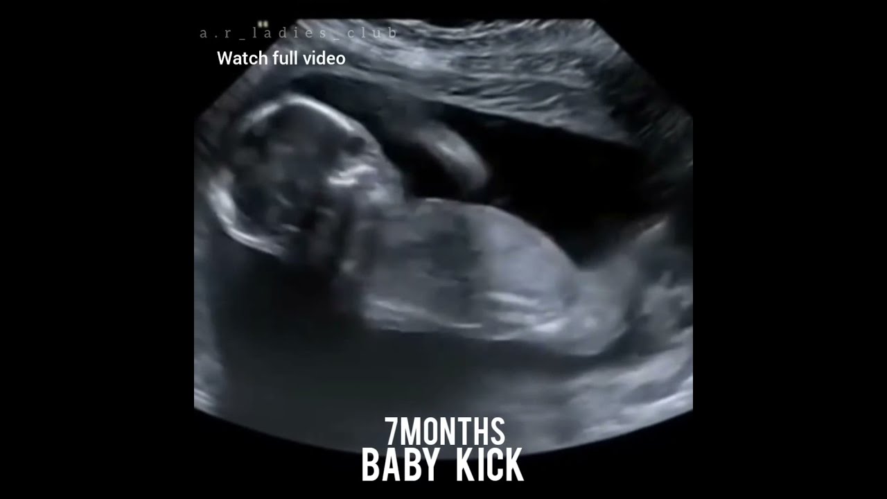 During 7 Months Pregnancy Baby Kick Babykicks Babykicking Youtube Shorts