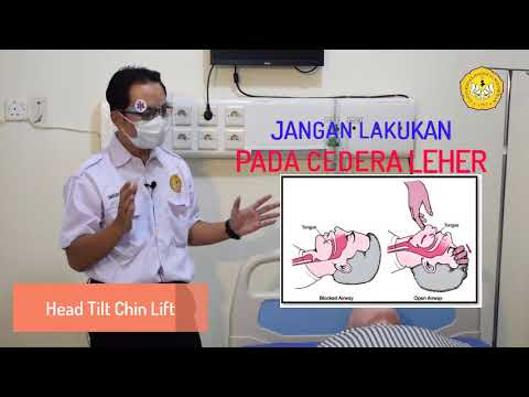 Video: Setengah Jatuh - Petunjuk Penggunaan, Ulasan, Kontraindikasi