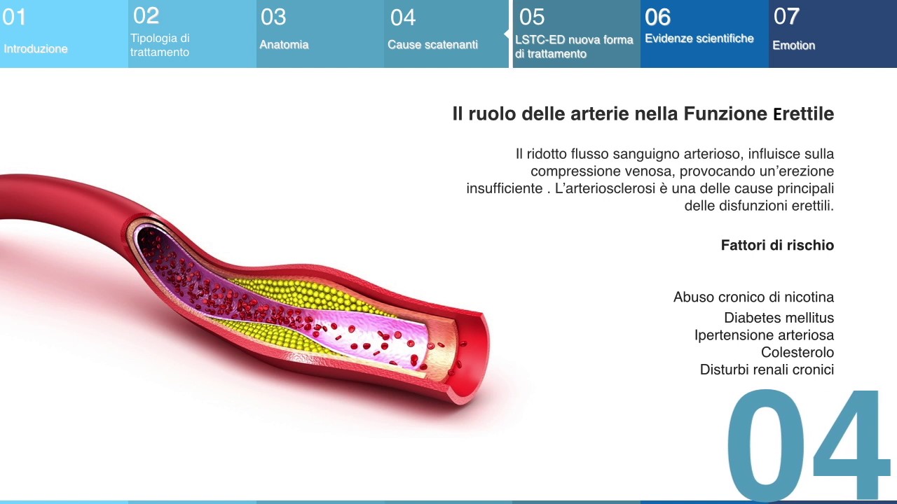 Onde D Urto Per Disfunzione Erettile Impiego delle onde d’urto nel trattamentode lla disfunzione erettile