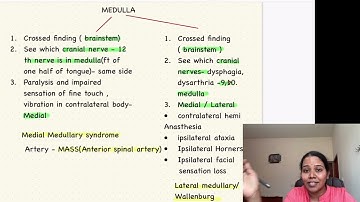 EASIEST AND QUICKEST WAY TO DIAGNOSE BRAIN STEM STROKE IN EXAMS. #neetpg2024 #internalmedicine