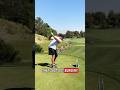 Patrick Mahomes will be ready to play week 1! #shorts #nfl #patrickmahomes