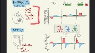 Non Invasive Ventilation - Part 2