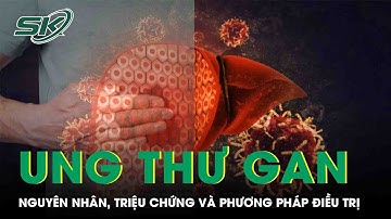 Ung Thư Gan: Nguyên Nhân, Triệu Chứng Và Điều Trị | SKĐS