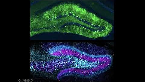 Manipulating Memories to Help Treat Brain Illness