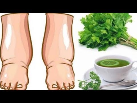 Video: Erbe Diuretiche Per Il Gonfiore Delle Gambe E Del Viso: Nomi, Ricette