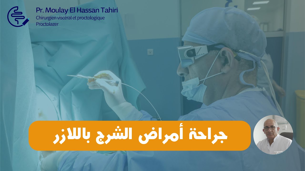 (Proctolaser)كل ما يجب معرفته عن جراحة أمراض الشرج باللازر مع البروفيسور مولاي الحسن طاهري.