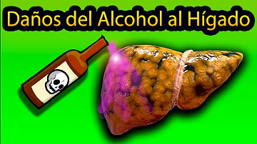 ¿Cómo saber si el hígado está dañado por el alcohol?