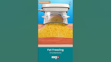 Cryolipolysis for Fat Reduction ↪ 3D Medical Animation #Shorts #Cryolipolysis #FatFreezing #Fat