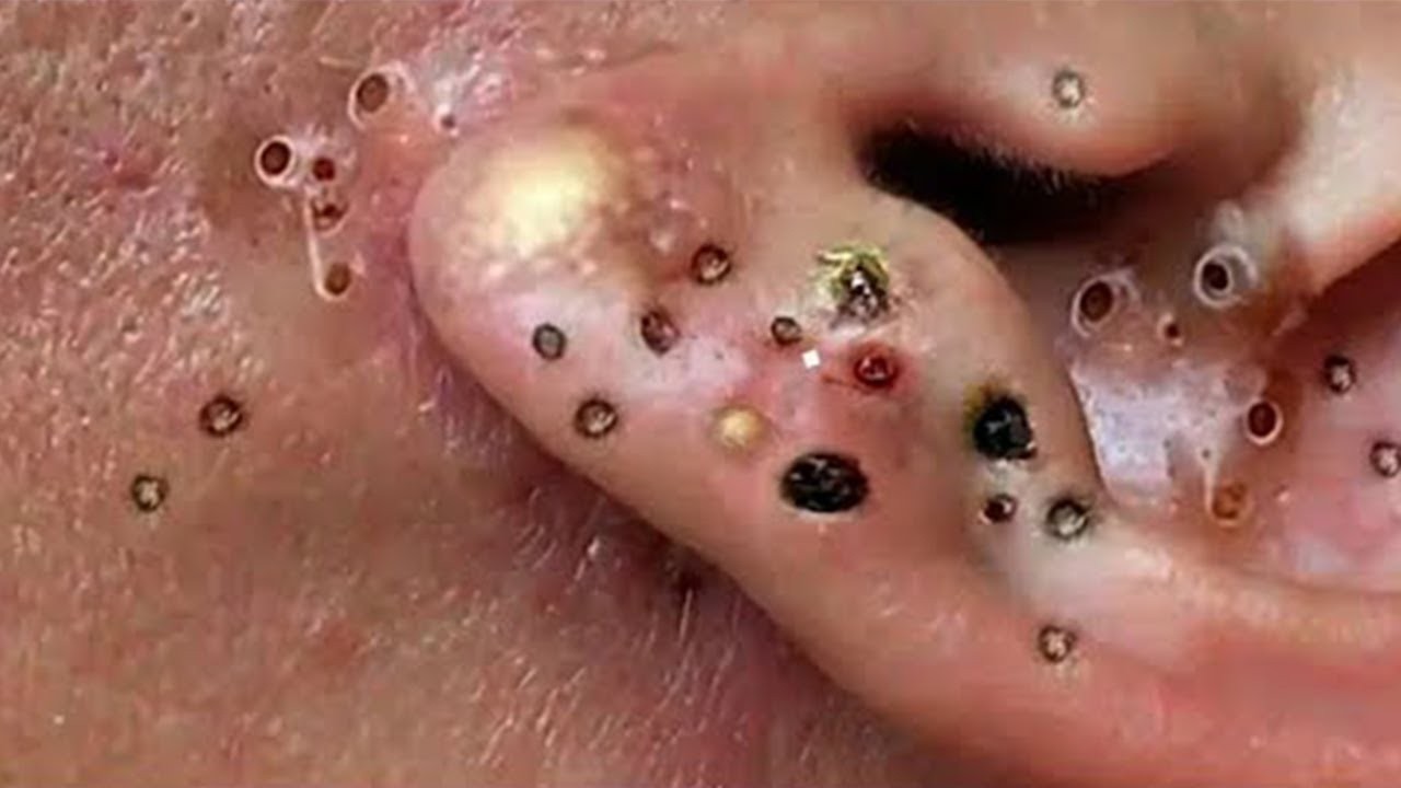 𝑅𝑒𝑐𝑙𝑎𝑖𝑚 𝑌𝑜𝑢𝑟 𝐺𝑙𝑜𝑤 𝐴𝑛𝑑 𝐶𝑎𝑙𝑚 𝑇ℎ𝑟𝑜𝑢𝑔ℎ 𝑀𝑖𝑛𝑑𝑓𝑢𝑙 𝑆𝑘𝑖𝑛𝑐𝑎𝑟𝑒 𝑀𝑜𝑚𝑒𝑛𝑡𝑠| 𝐷𝑒𝑒𝑝 𝐶𝑙𝑒𝑎𝑛𝑠𝑖𝑛𝑔 & 𝑆𝑜𝑜𝑡ℎ𝑖𝑛𝑔 𝑀𝑎𝑠𝑠𝑎𝑔𝑒 #9048