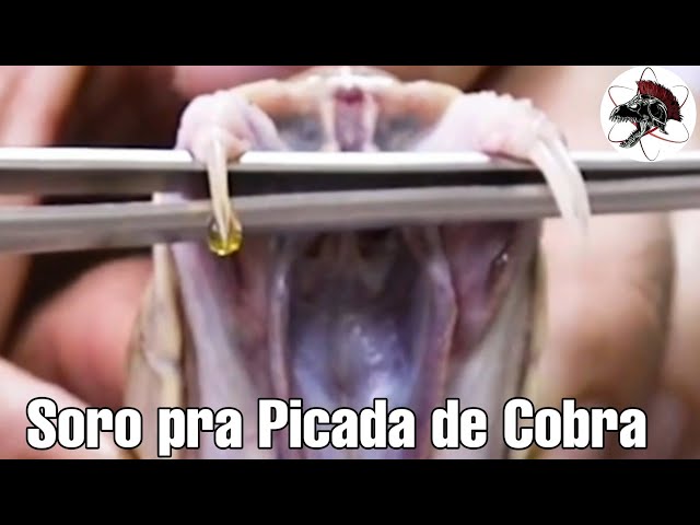 Soro Específico pessoa e picada de cobra 