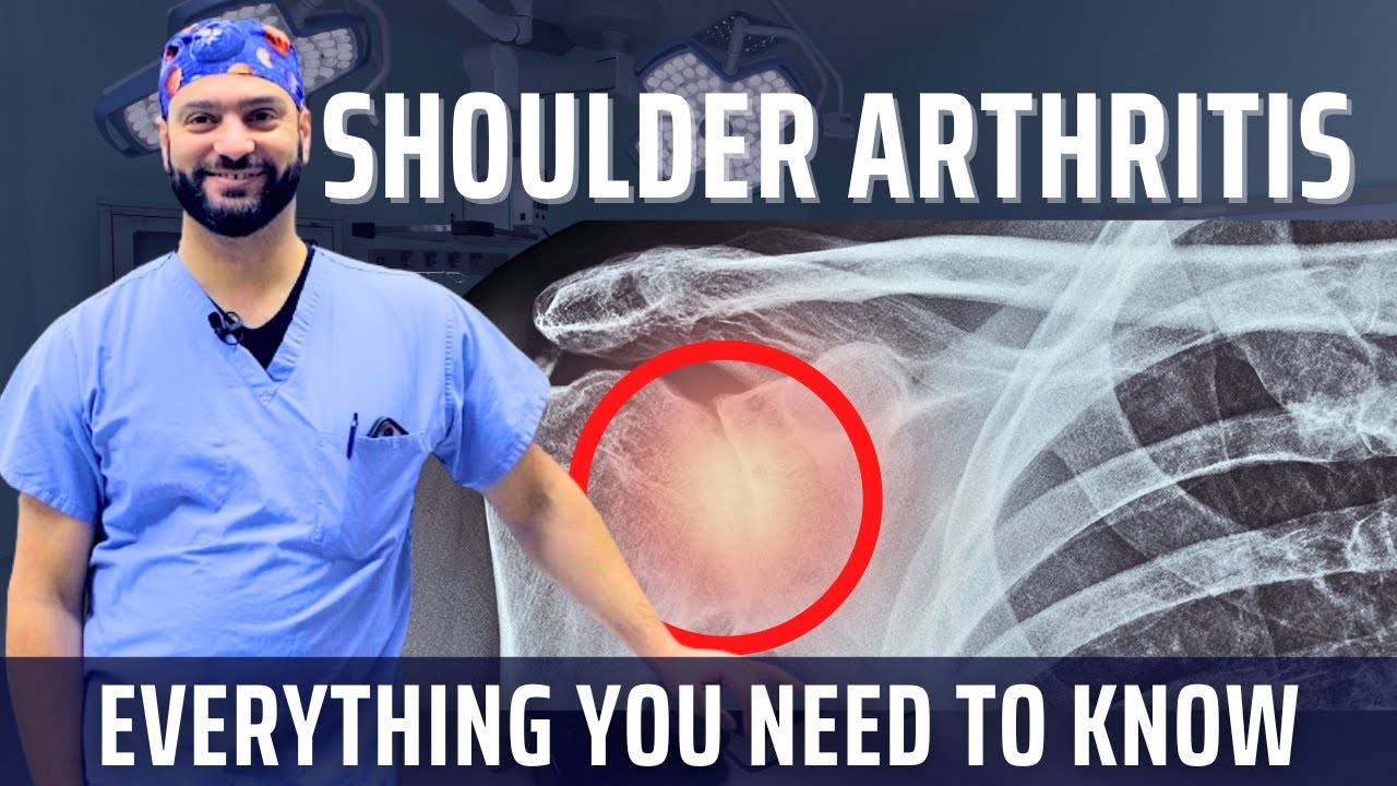 Shoulder Arthritis, Explained