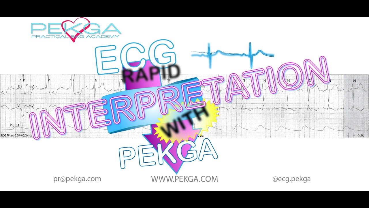 PACEMAKER ATRIAL FLUTTER - RAPID ECG - PEKGA