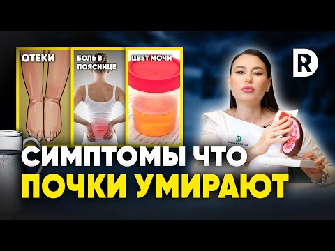 5 симптомов ЗАБОЛЕВАНИЯ ПОЧЕК. Чем ОПАСНЫ проблемы с ПОЧКАМИ.