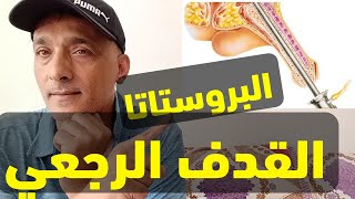 القدف الرجعي بعد استئصال جزء من البروستاتا