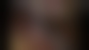 Large Gastrointestinal Stromal Tumours of the Stomach: Laparoscopic Atypical Resection