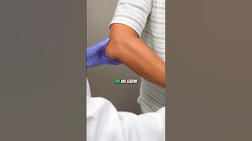 What happened to his elbow?!😱 #painmanagement #elbowpain