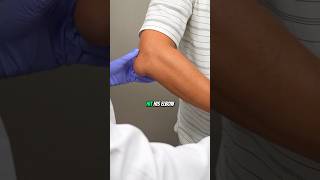 What happened to his elbow?!😱 #painmanagement #elbowpain
