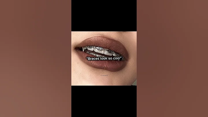 iykyk👽#shortsviral #aesthetic #shortvideo #trending #beauty #braces#fyp