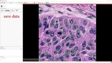 Slicer Pathology Tutorial
