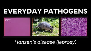 What is leprosy? A brief overview of Hansen's disease and impact in Florida.