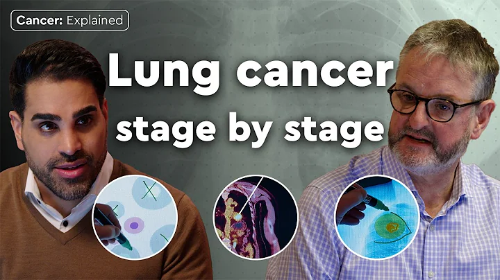Stages of Lung Cancer Explained By Dr Ranj