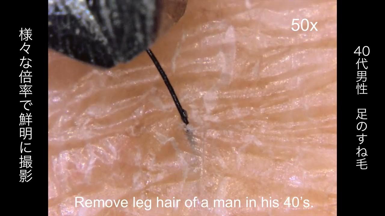 plucking-leg-hair-under-microscope-goko-ev-6hd-made-in-japan-youtube