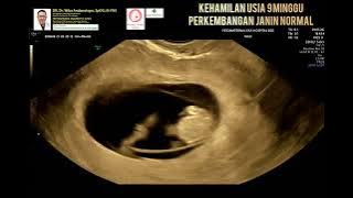 Kehamilan 9 minggu normal