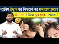  dandruff        permanent treatment for dandruff