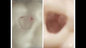 ORE 2 MANIKIN COURSE BIRMINGHAM