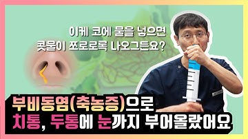 부비동염(축농증) 은 어떤 증상이며, 어떻게 치료해야 할까?