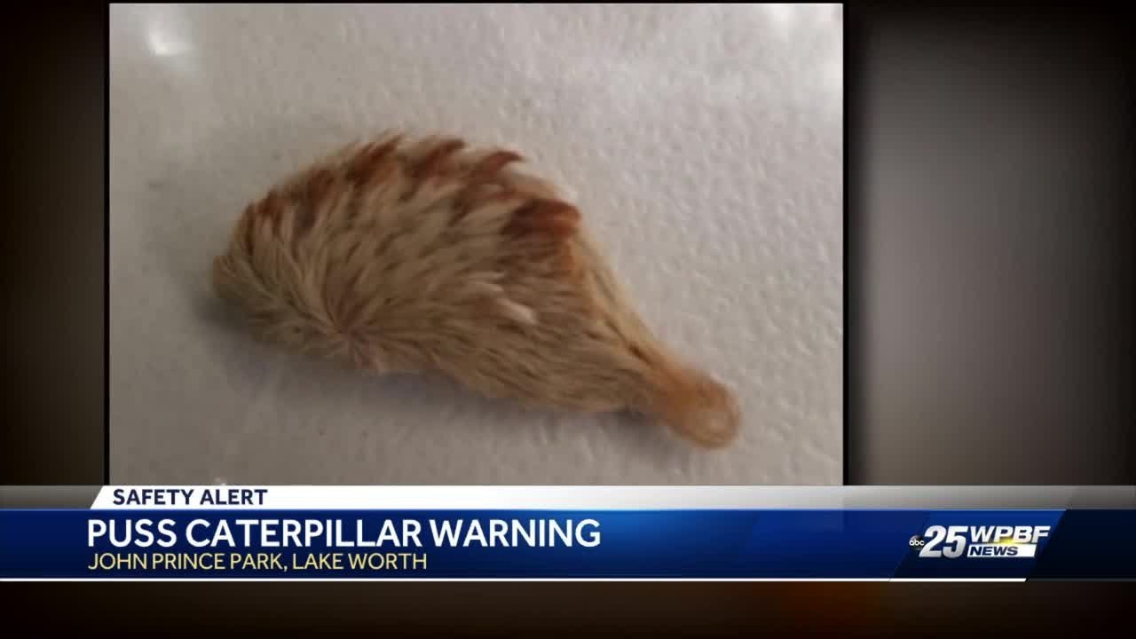 Puss caterpillar warning