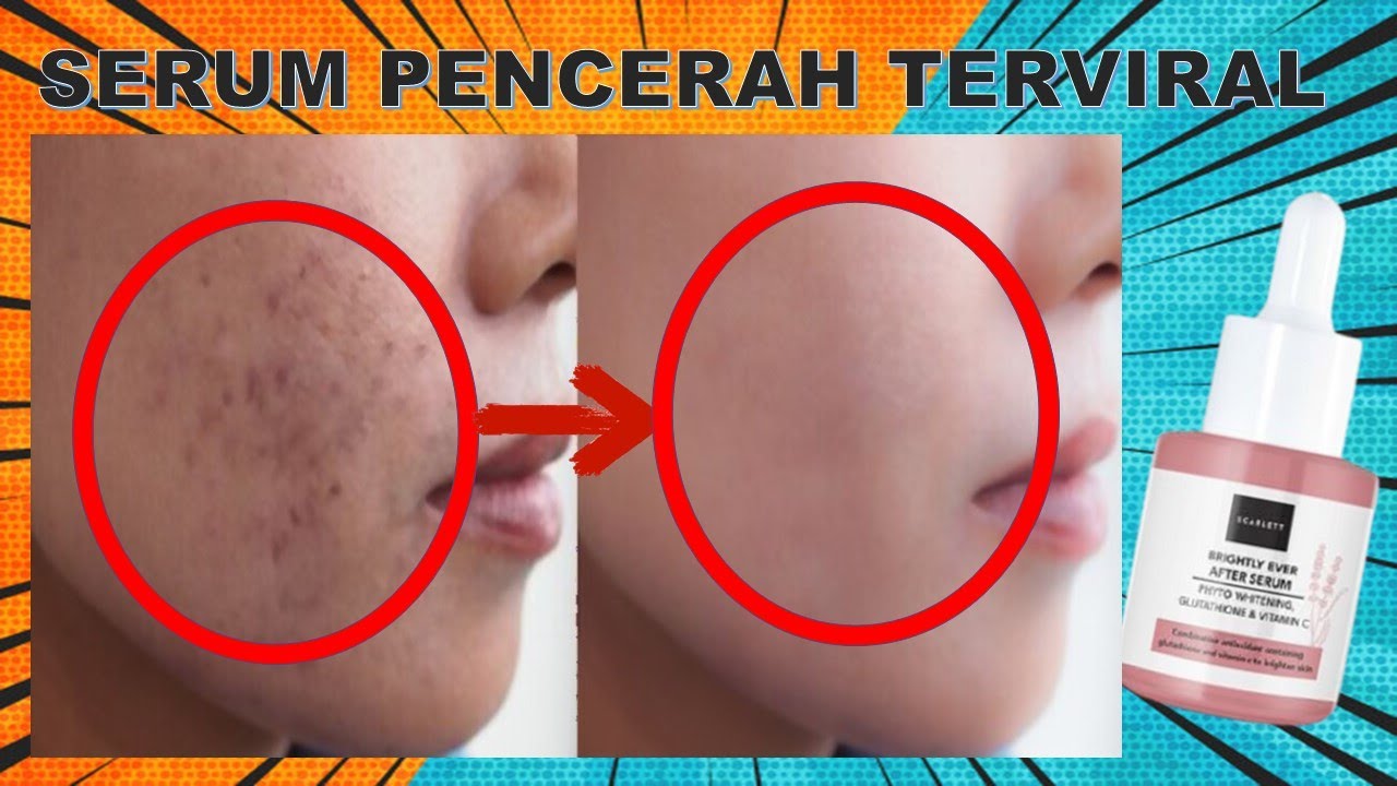 manfaat serum scarlett whitening brightly