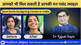 Digital Smile Designing Treatment | Smile Correction | Smile Makeover in India