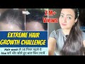 30 Days Hair Growth Challenge 2021 : Hair Wash करने से 15 मिनट पहले USE करें और खोये बाल वापस उगायें
