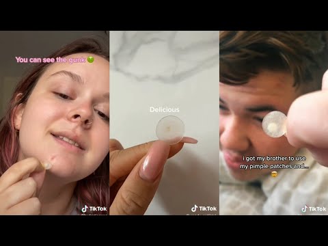 Video: 9 Acne-patches Om Nu Te Proberen