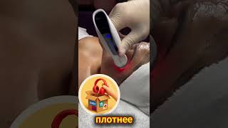 Лазер заменил все крема для лица #shorts #массажер