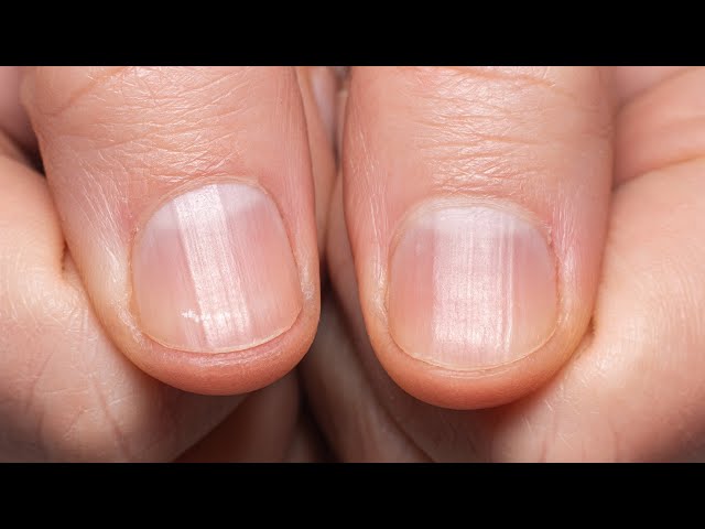 Fingernail Care for Seniors - Avon Health Center