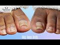 👣Big Toes Only - Pedicure TOENAIL CLEANING at Home👣