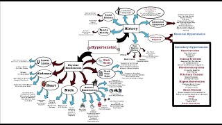 Hypertension  OSCE