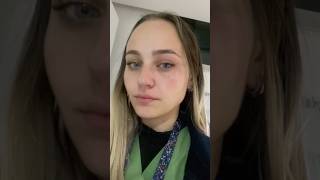 Da Bahsettiğim Süreçle Ilgili Kanalımda ✨