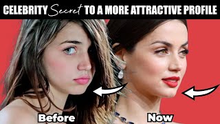 Chin Filler Before & After Celebrity Secret to an Attractive Profile