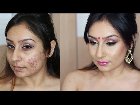 Tutorial acne rosacea foundation routine makeup tutorial | Makeup With Raji