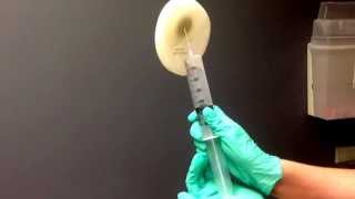 Breast Reconstruction: Expanders and the Fill Process Profile